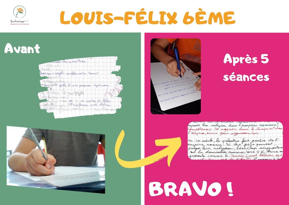 Avant/Après Louis-Félix